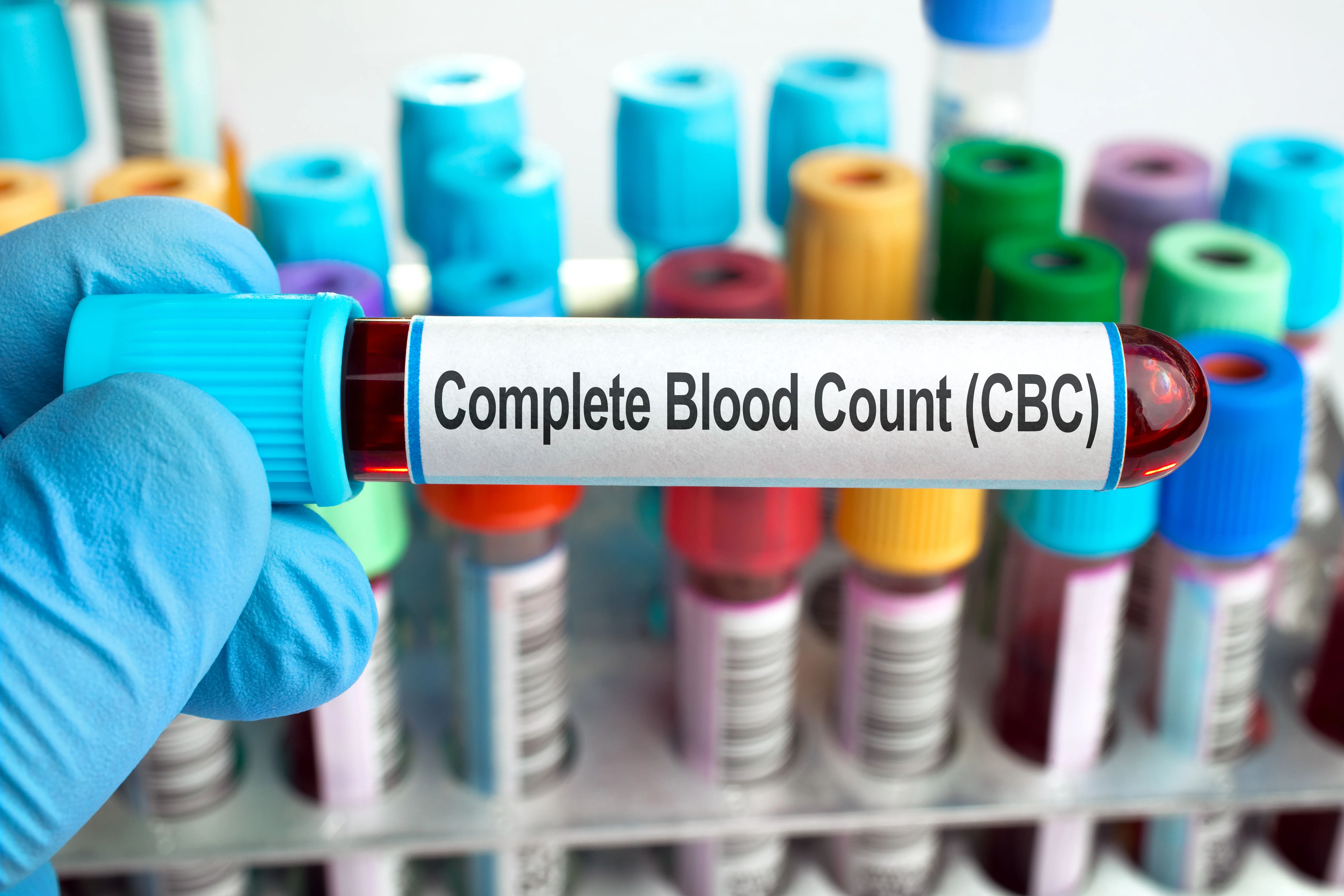 complete blood count