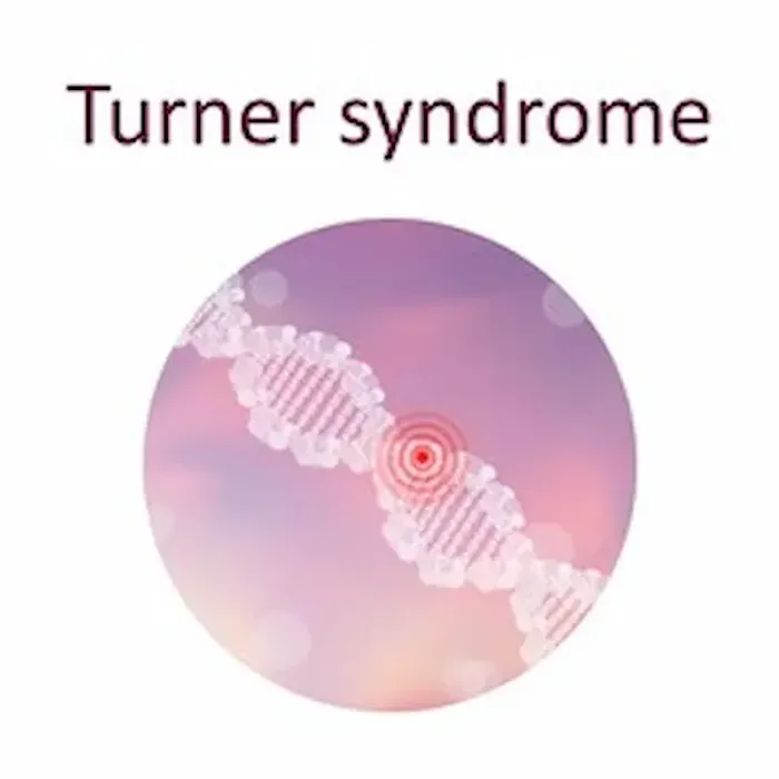 Turner Syndrome