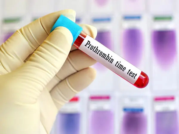 Prothrombin Time Test