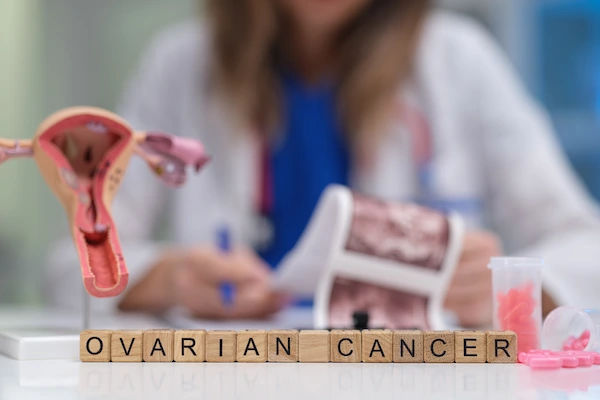 ovarian cancer