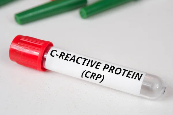 Reducing CRP Levels with Lifestyle and Diet
