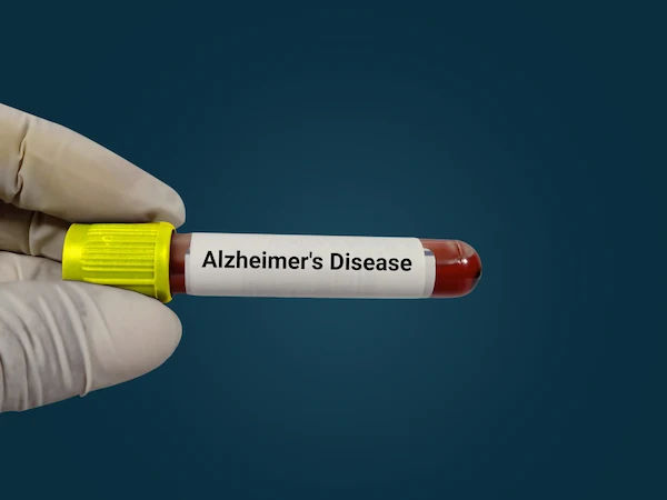 Alzheimer's Disease