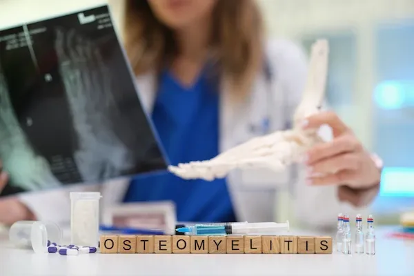 Osteomyelitis: Symptoms, Causes and Treatment