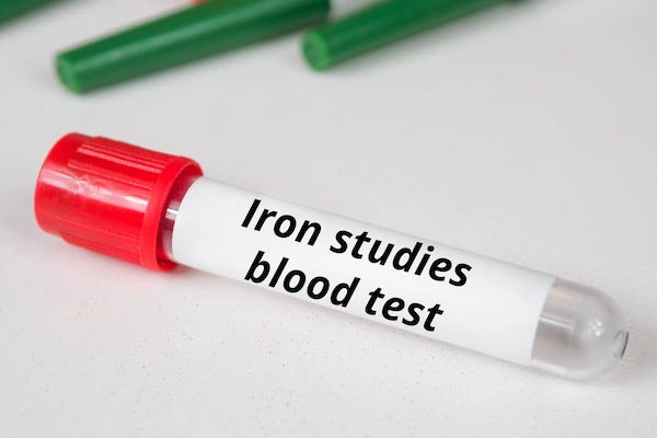 iron studies
