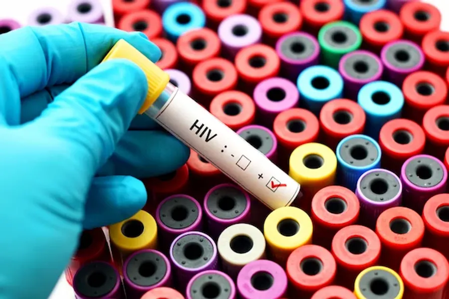 Signs and Symptoms of HIV in Men and Women