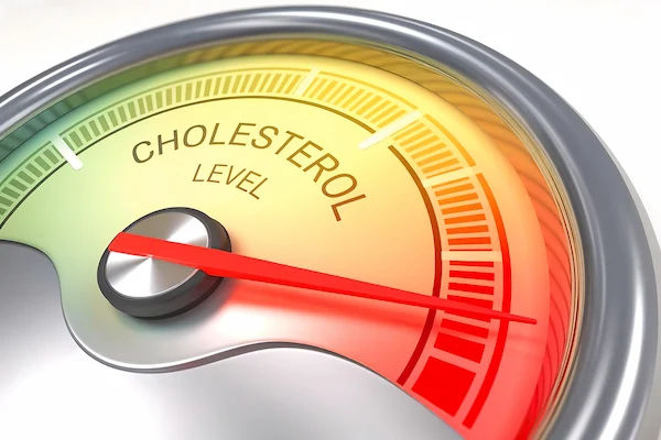 cholesterol