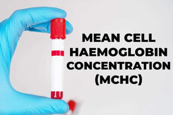 MCHC Blood