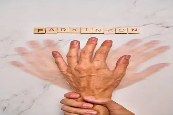 parkinsonism