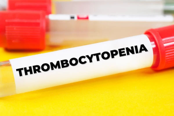 Thrombocytopenia Symptoms and Causes