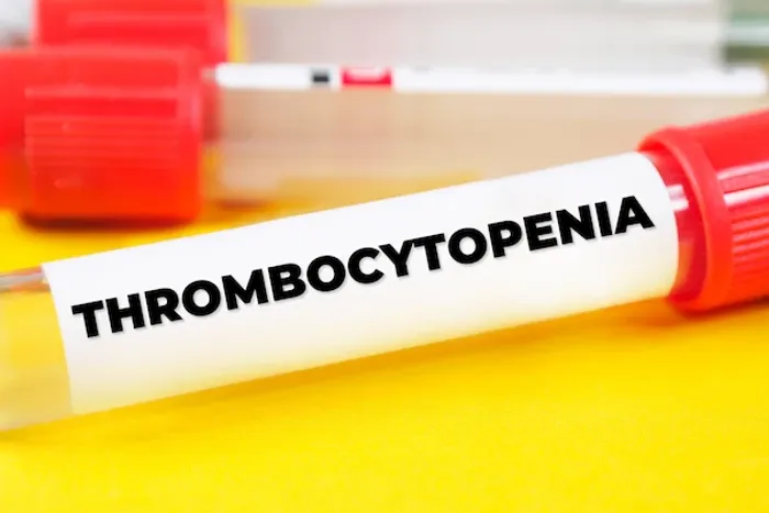 Thrombocytopenia Symptoms and Causes
