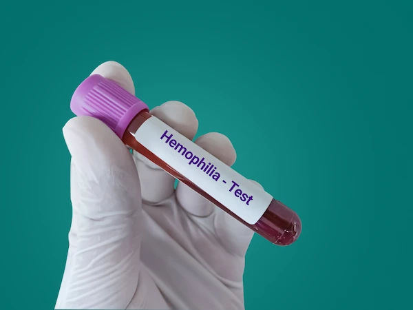 Understanding Hemophilia: Symptoms, Causes, and Treatment