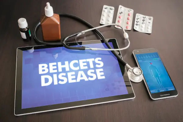 Behcet's Disease