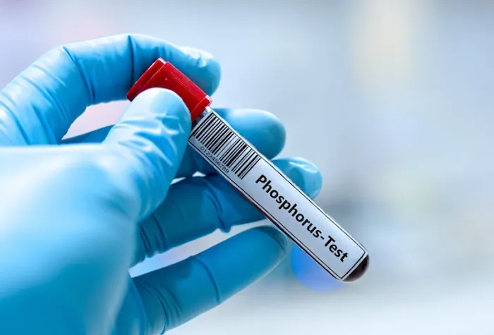 phosphorus test