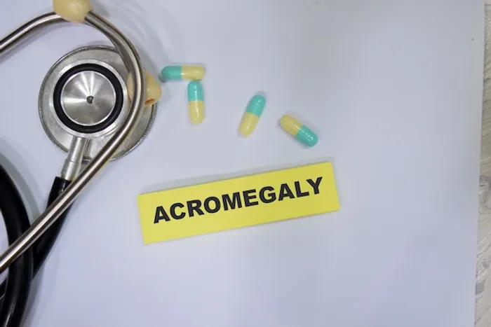 acromegaly