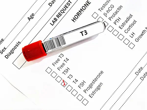 T3 Testing for Thyroid