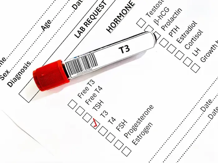 T3 Testing for Thyroid