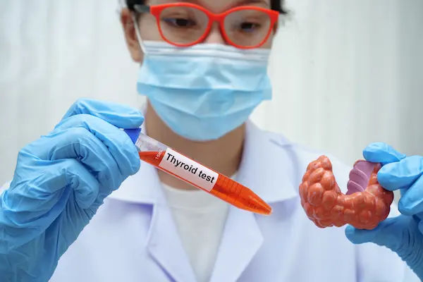 Thyroid Tests