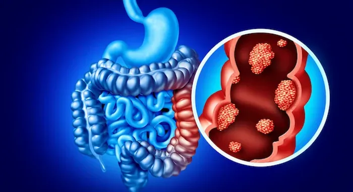 Malignant and Benign Tumours