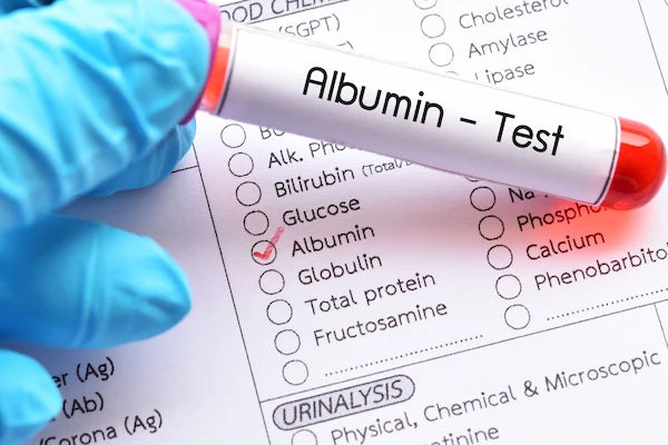 Albumin Test Overview and Procedure