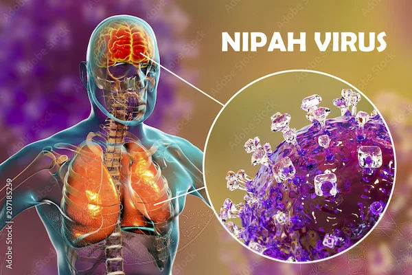 Nipah Virus Overview and Prevention Measures