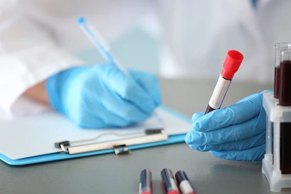blood test