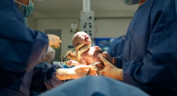 neonatal respiratory distress syndrome
