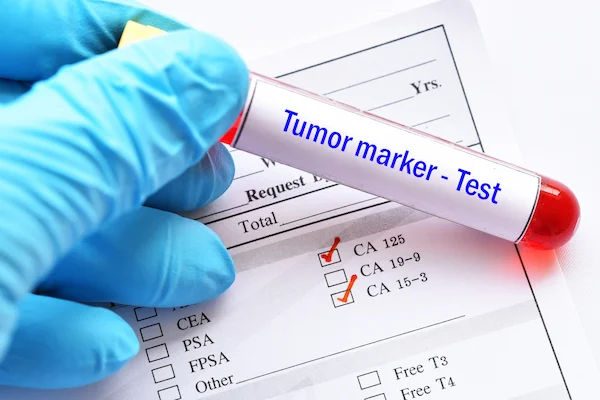 Tumour Markers and Their Applications