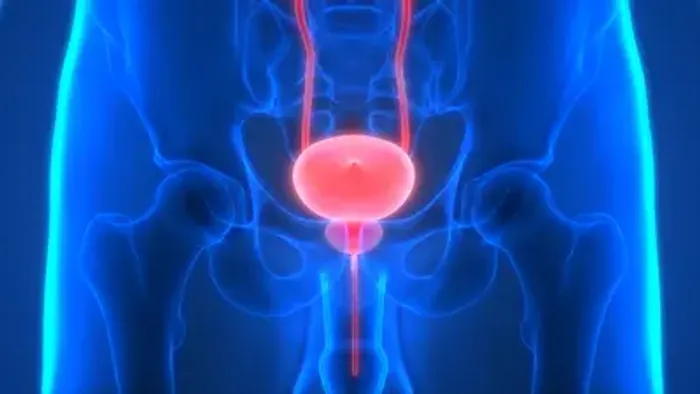 The Role of Free PSA in Diagnosing Prostate Problems
