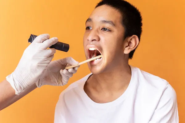 Tonsil