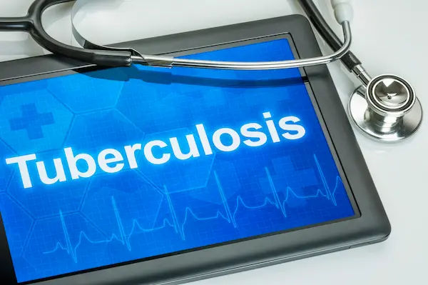 Types of Tuberculosis