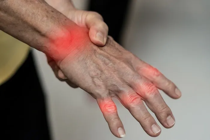 Diagnosis of Rheumatoid Arthritis Explained