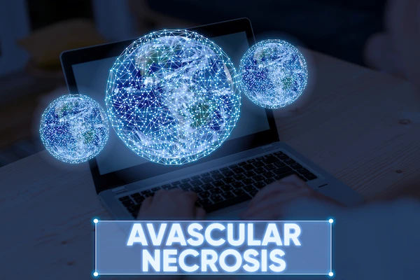 Avascular Necrosis