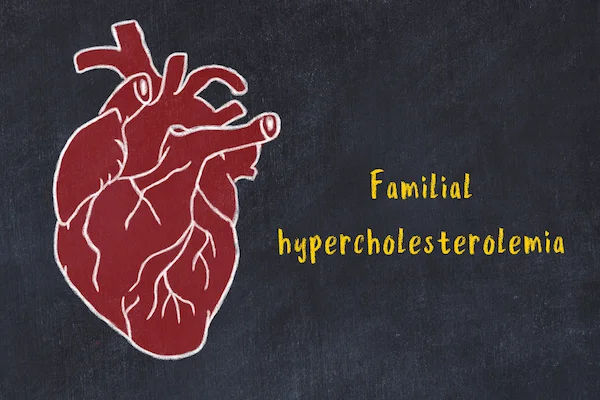 hypercholesterolemia