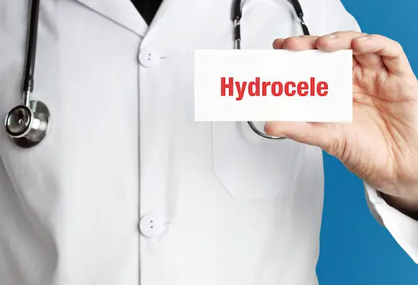Hydrocele
