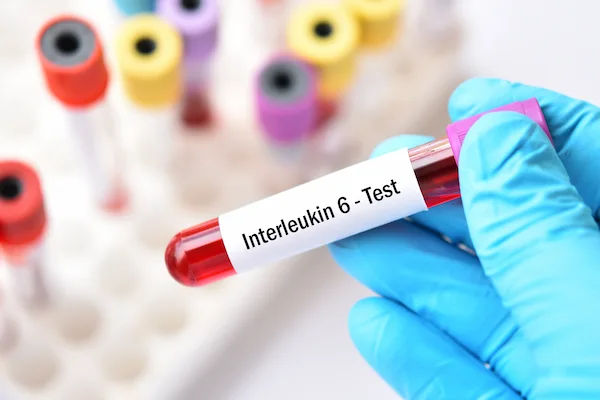 Interleukin (IL-6) Test Overview