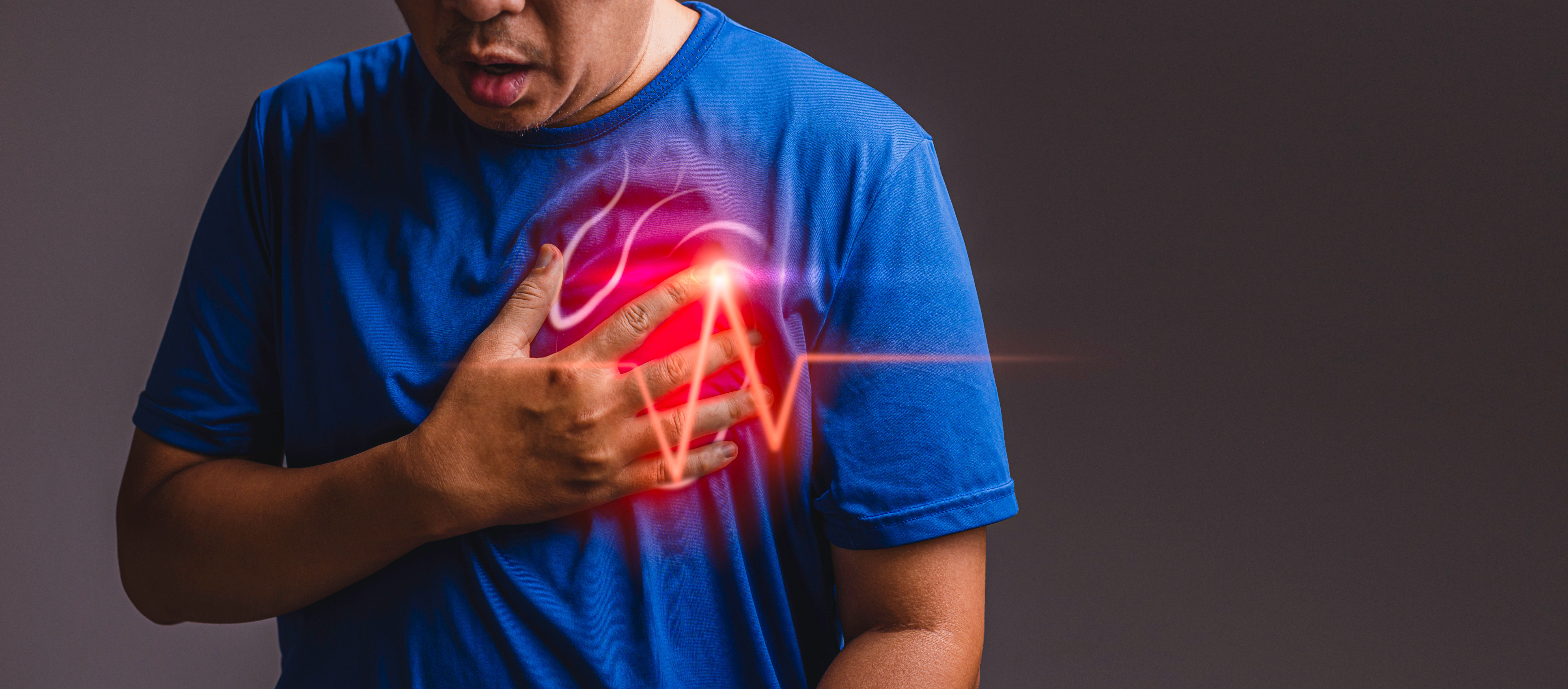 Coronary Artery Disease Overview