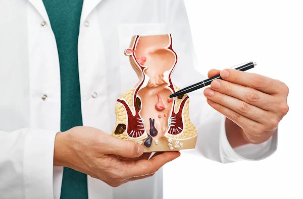 Rectal Manometry Procedures