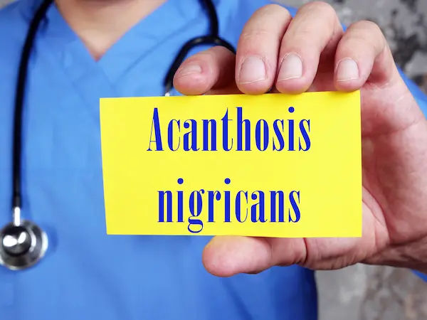 Acanthosis Nigricans
