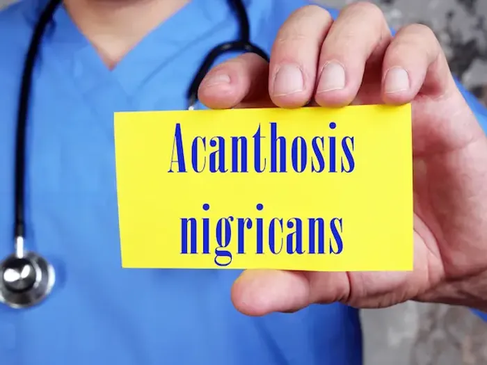 Acanthosis Nigricans