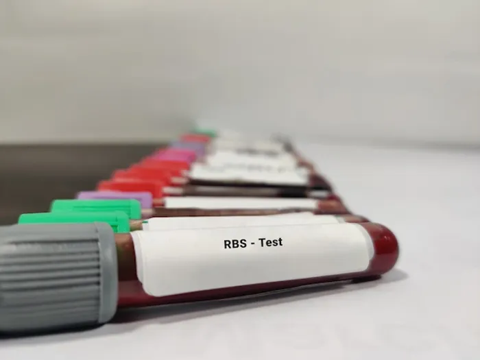 rbs test