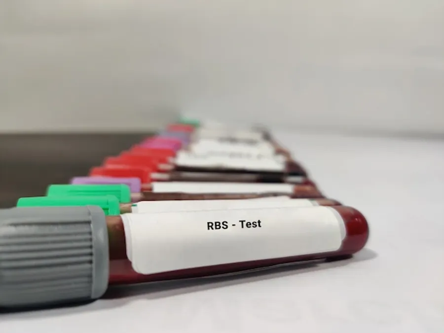 Is Your Child’s Sudden Tiredness Linked to Blood Sugar? RBS Test ...