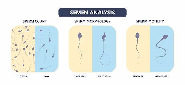 Find Seminogram Test Locations Nearby