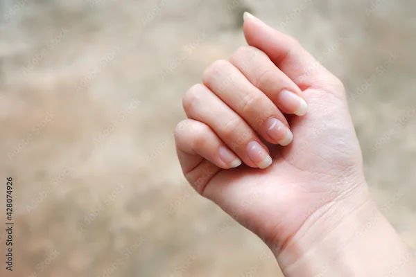 White Spots on Nails: Causes and Treatment