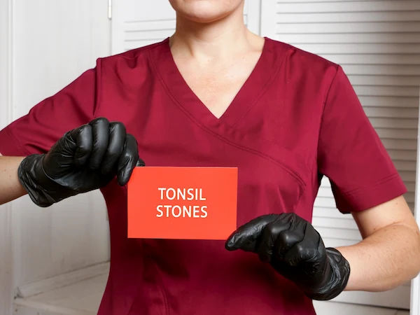 tonsil stones