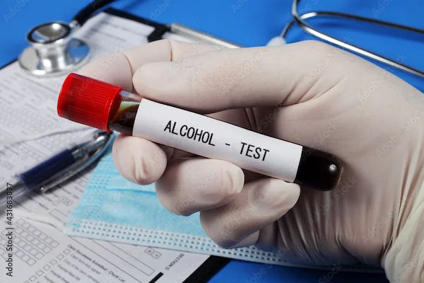Alcohol Blood Tests Overview and Process