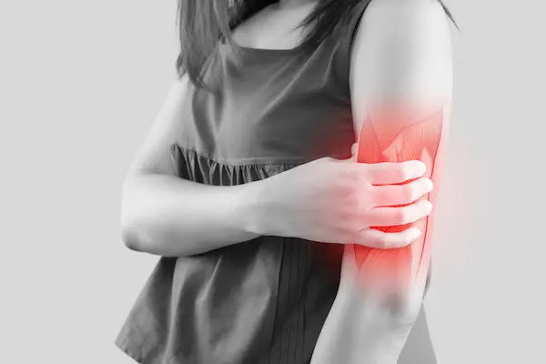 Myositis
