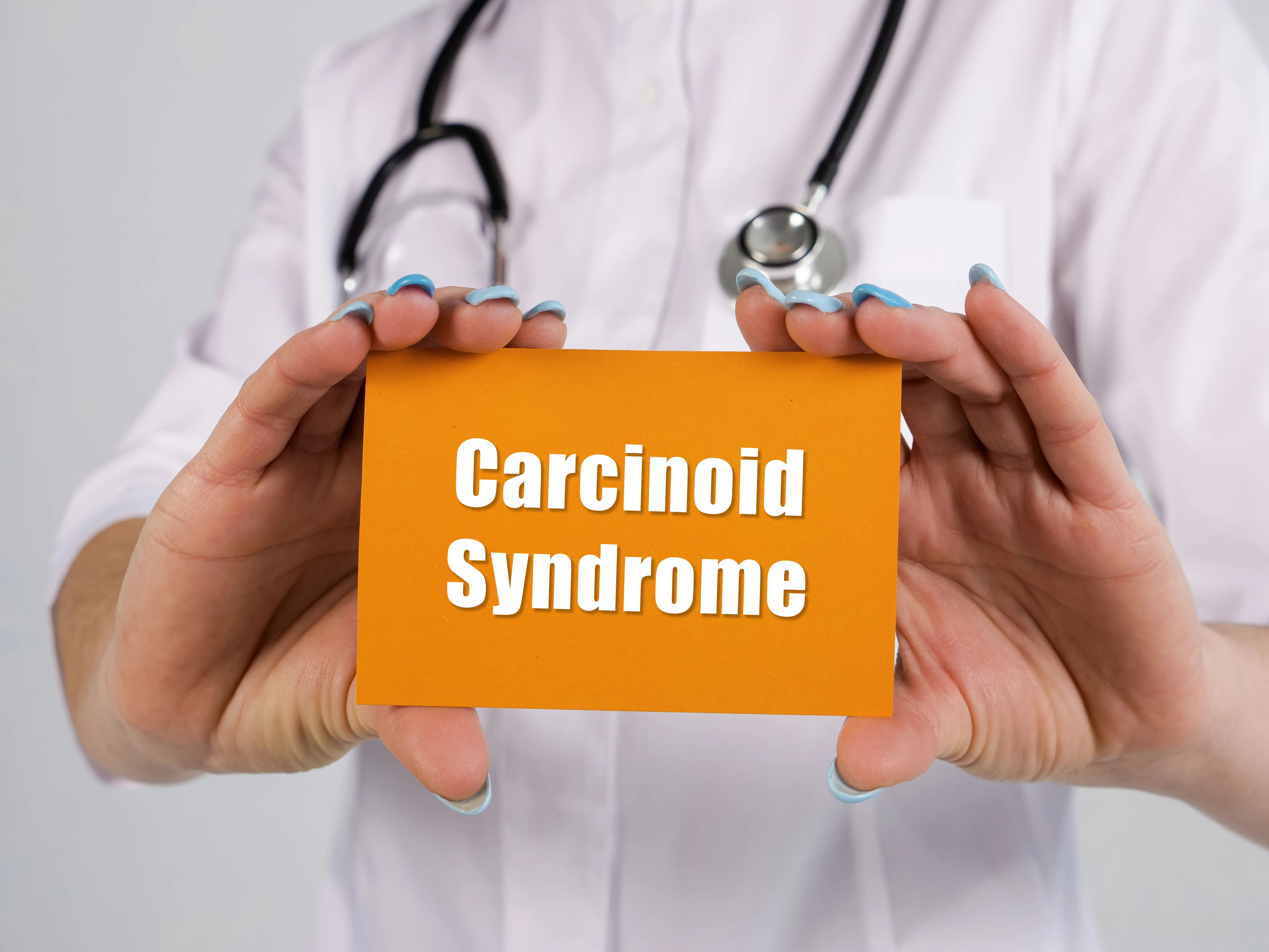 Carcinoid Syndrome Overview and Management