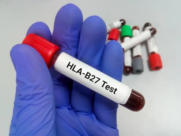 hla-b27