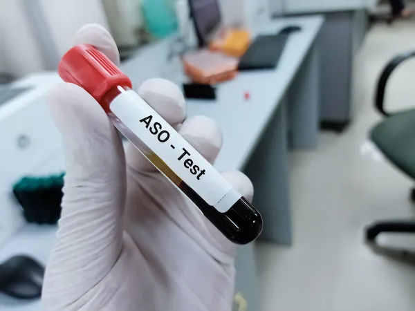 ASO Test