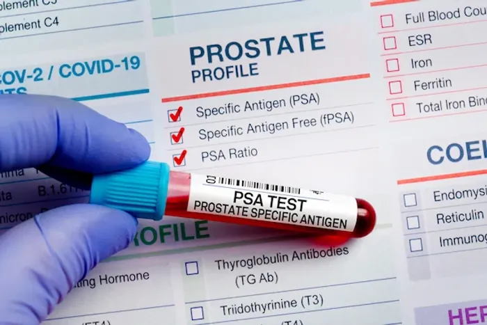 psa test